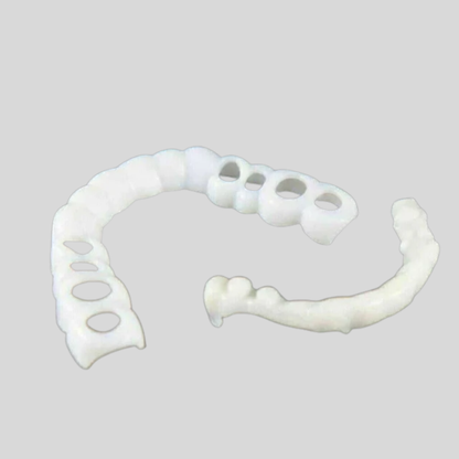 Snap On Dental Veneers Smile Enhancement