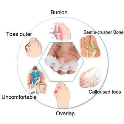 Orthopedic Toe Separator