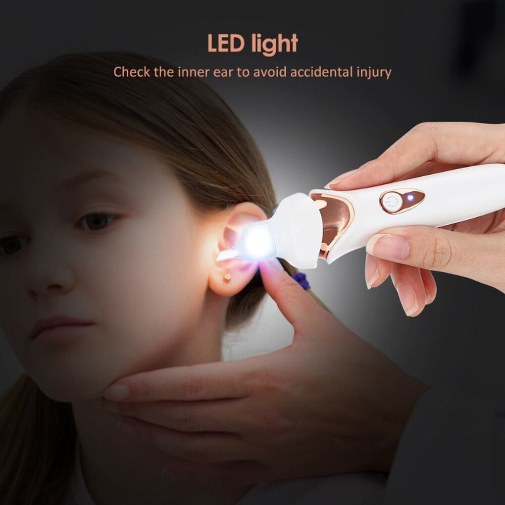 Ear Wax Removal Vacuum Cleaner - Fashinoza